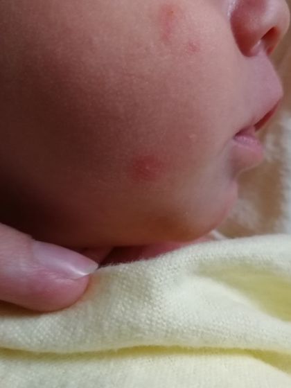 Выскочило сегодня на щечке
