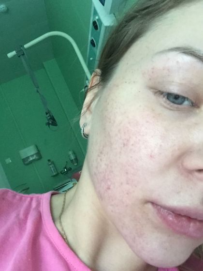У кого такое было в родах?