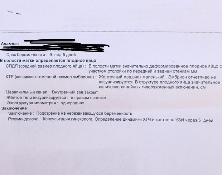 Реву? 9 Акушерских..ЗАМЕРШАЯ