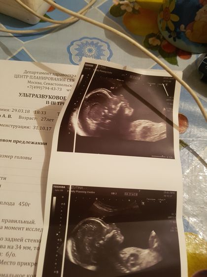 Сходила на второй Скренинг .