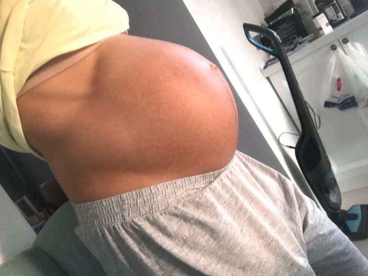 30 недель. Двойня🤰🏻