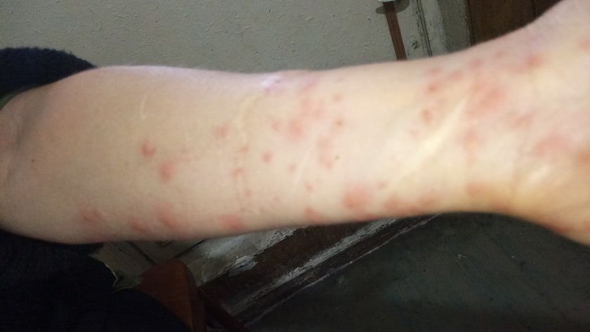 У знакомой вылезло это,