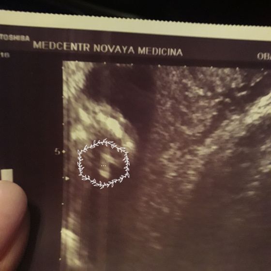 Третий пацан=)