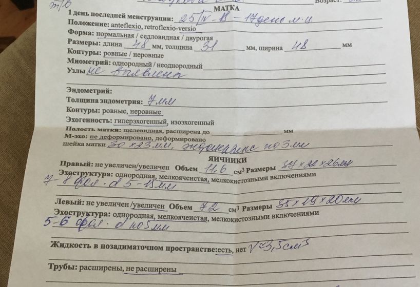 УЗИ