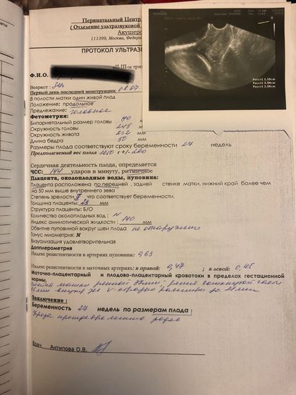 Положили на сохранение