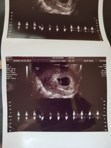Heartbeat..❤