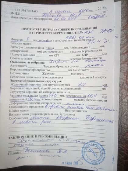 Подтвердили беременность.