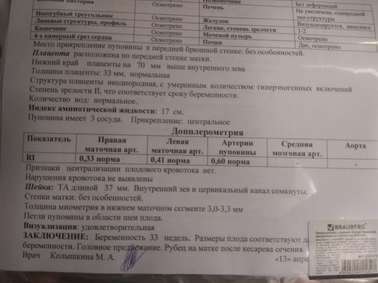 Показатели допплера