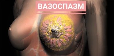 Вазоспазм