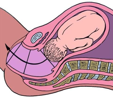 ДЛИНА ШЕЙКИ МАТКИ И РОДЫ 🤰🏻 💪🏽