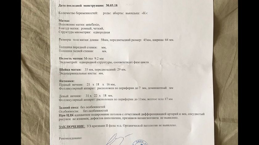 21 дц