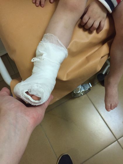 Сын в гипсе,я в панике