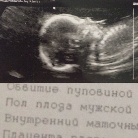 Ураааа!!!