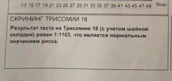 Инвитро VS KDL