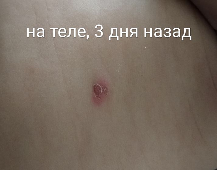 Появились пузырьки, на вид