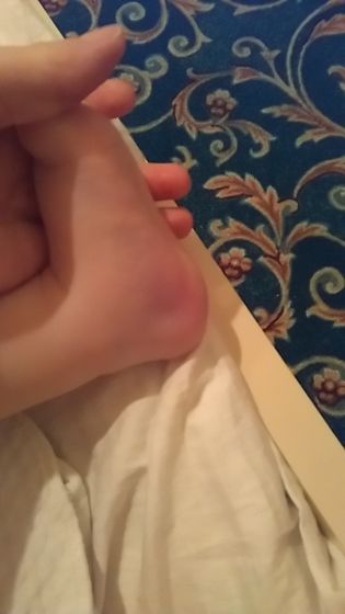 Девочки видите эти шишки