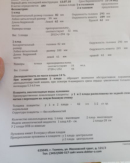 33 недели моно ди